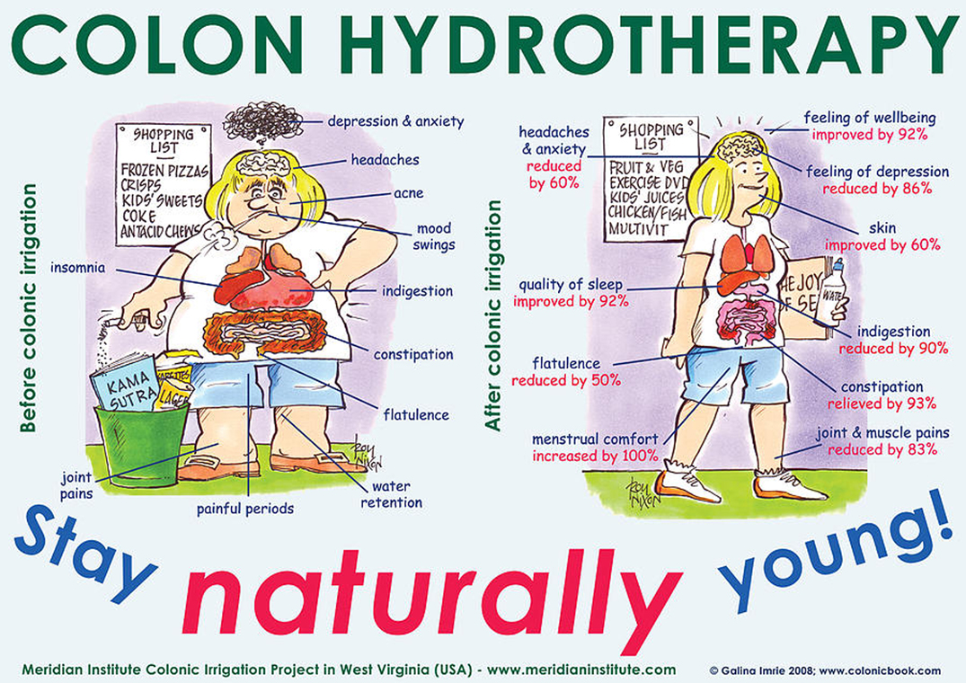 Colon Hydrotherapy Stay Naturally Young Galina Imrie